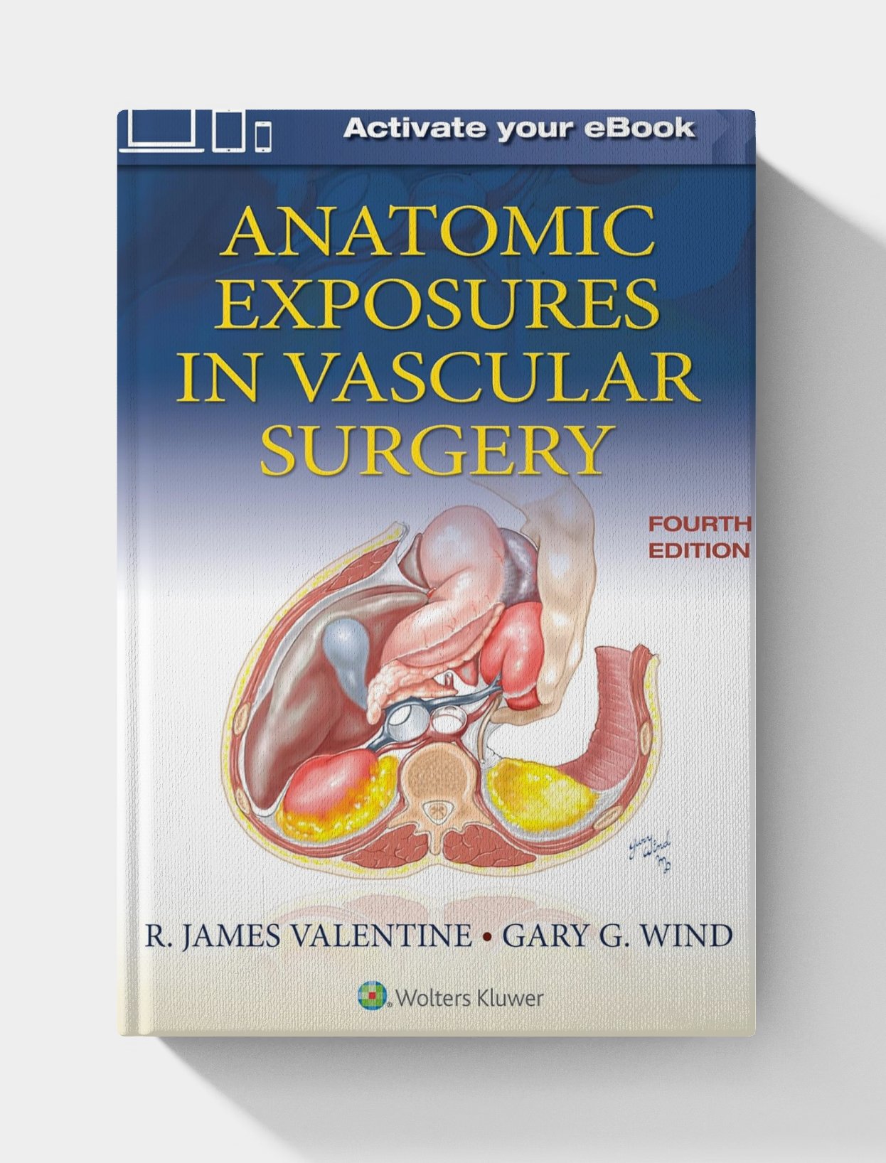 Anatomic Exposures in Vascular Surgery (4th Edition) Anatomic Exposures in Vascular Surgery (4th Edition)