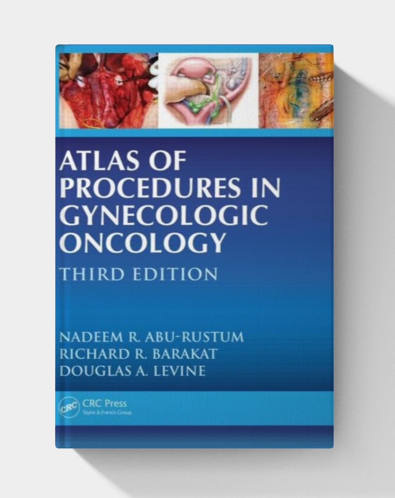 Atlas of Procedures in Gynecologic Oncology (3rd edition) PDF ONLY Atlas of Procedures in Gynecologic Oncology (3rd edition) PDF ONLY