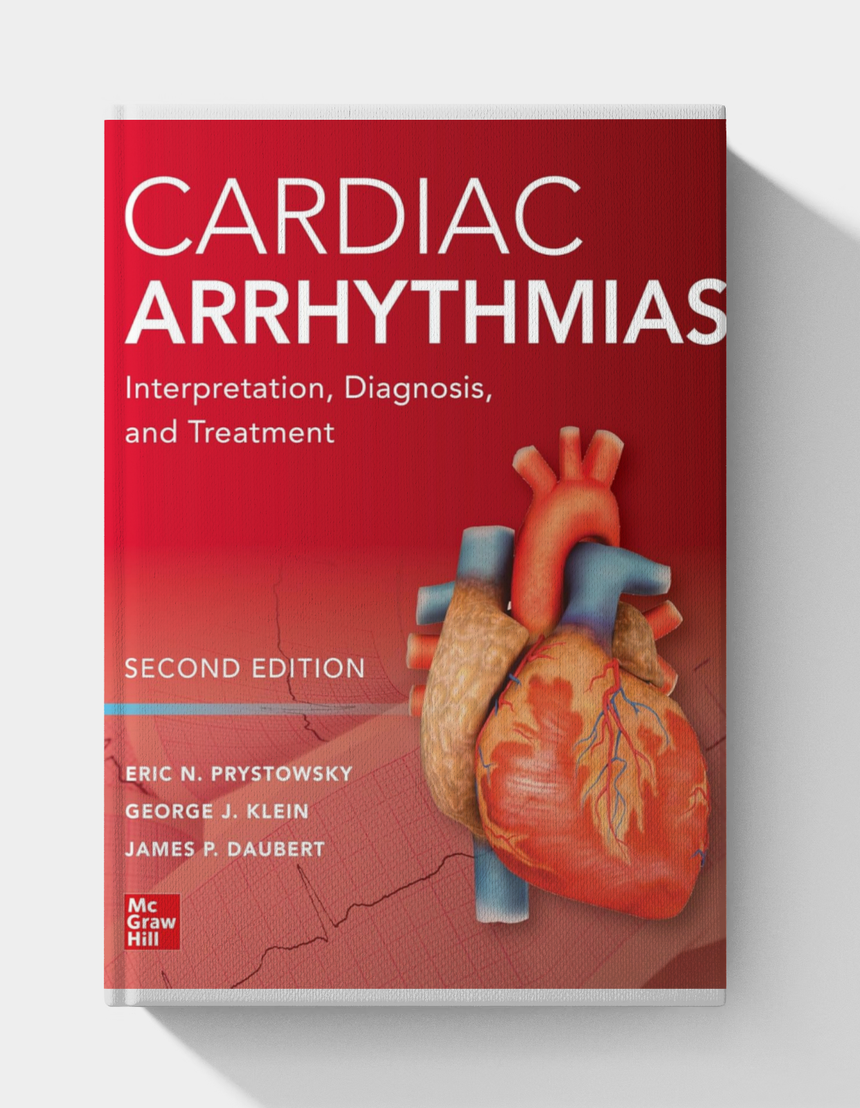 Cardiac Arrhythmias: Interpretation, Diagnosis and Treatment Cardiac Arrhythmias: Interpretation, Diagnosis and Treatment