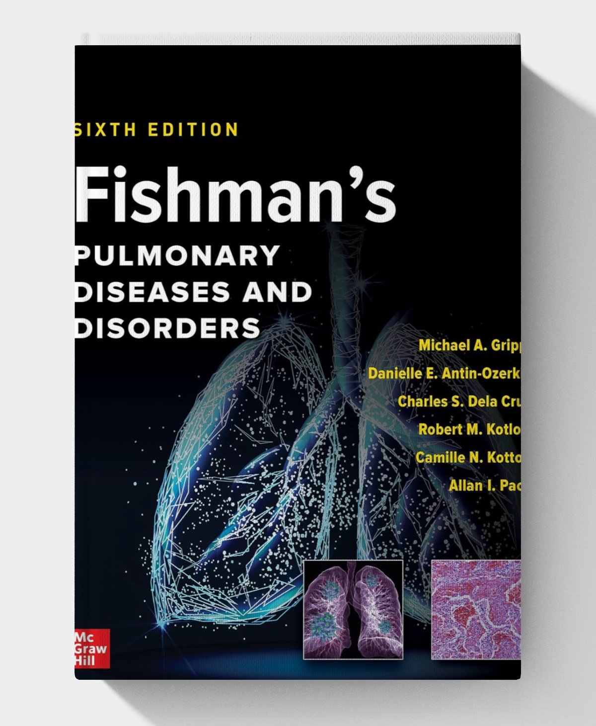 Fishman's Pulmonary Diseases and Disorders, 2-Volume Set (6th Edition) Fishman's Pulmonary Diseases and Disorders, 2-Volume Set (6th Edition)