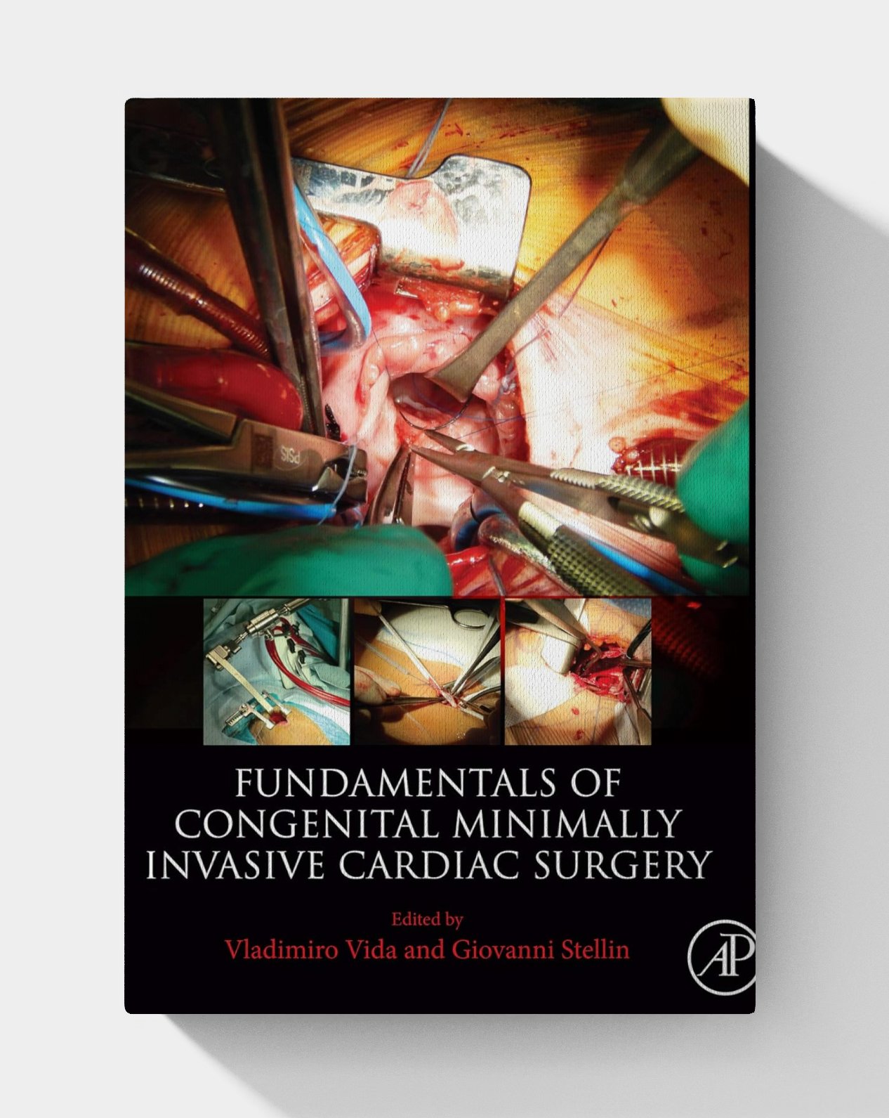 Fundamentals of congenital minimally invasive cardiac surgery Fundamentals of congenital minimally invasive cardiac surgery