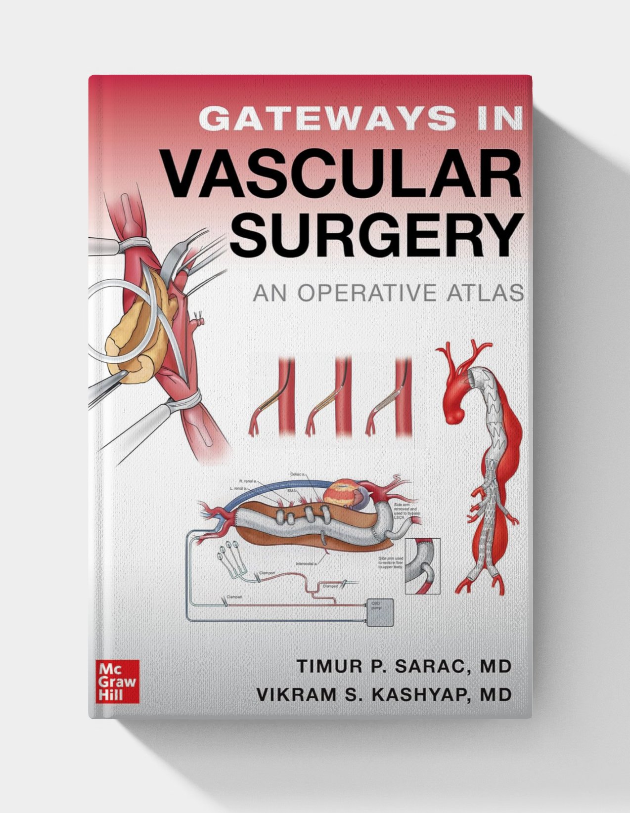Gateways in Vascular Surgery: An Operative Atlas (1st Edition) Gateways in Vascular Surgery: An Operative Atlas (1st Edition)