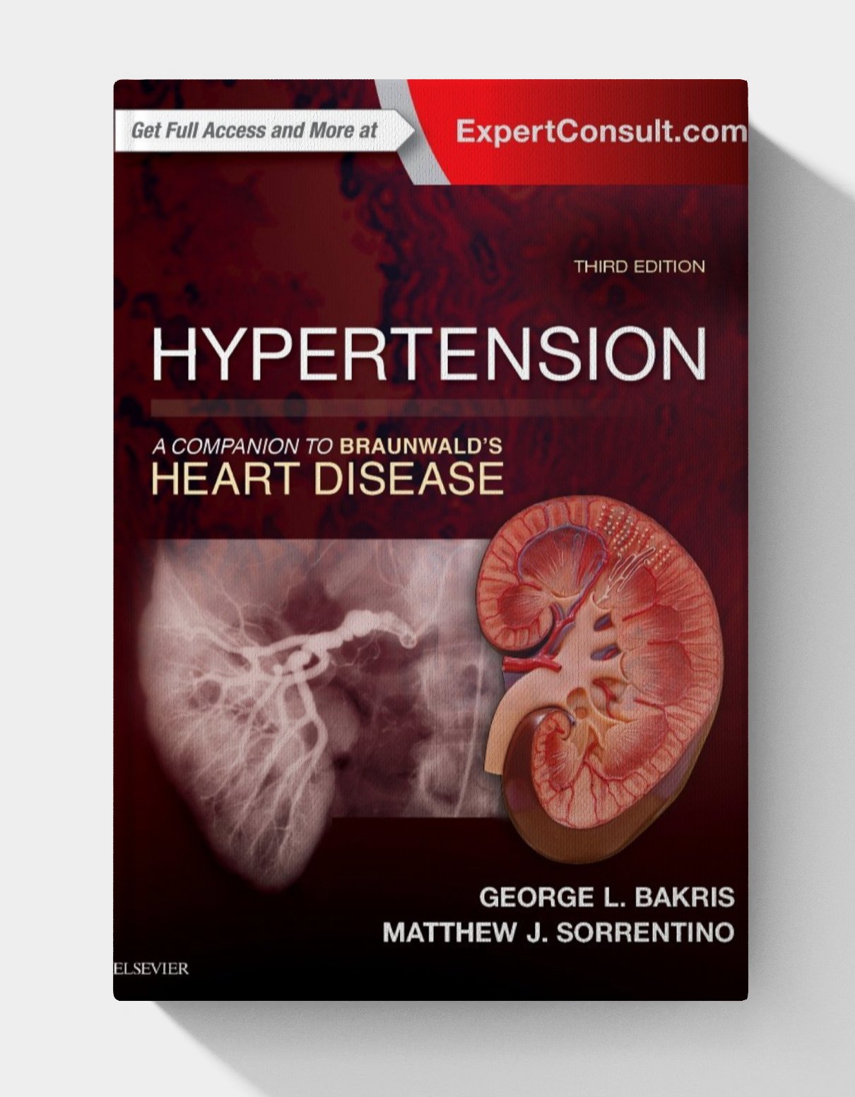 Hypertension: A Companion to Braunwald's Heart Disease (3rd Edition) Hypertension: A Companion to Braunwald's Heart Disease (3rd Edition)