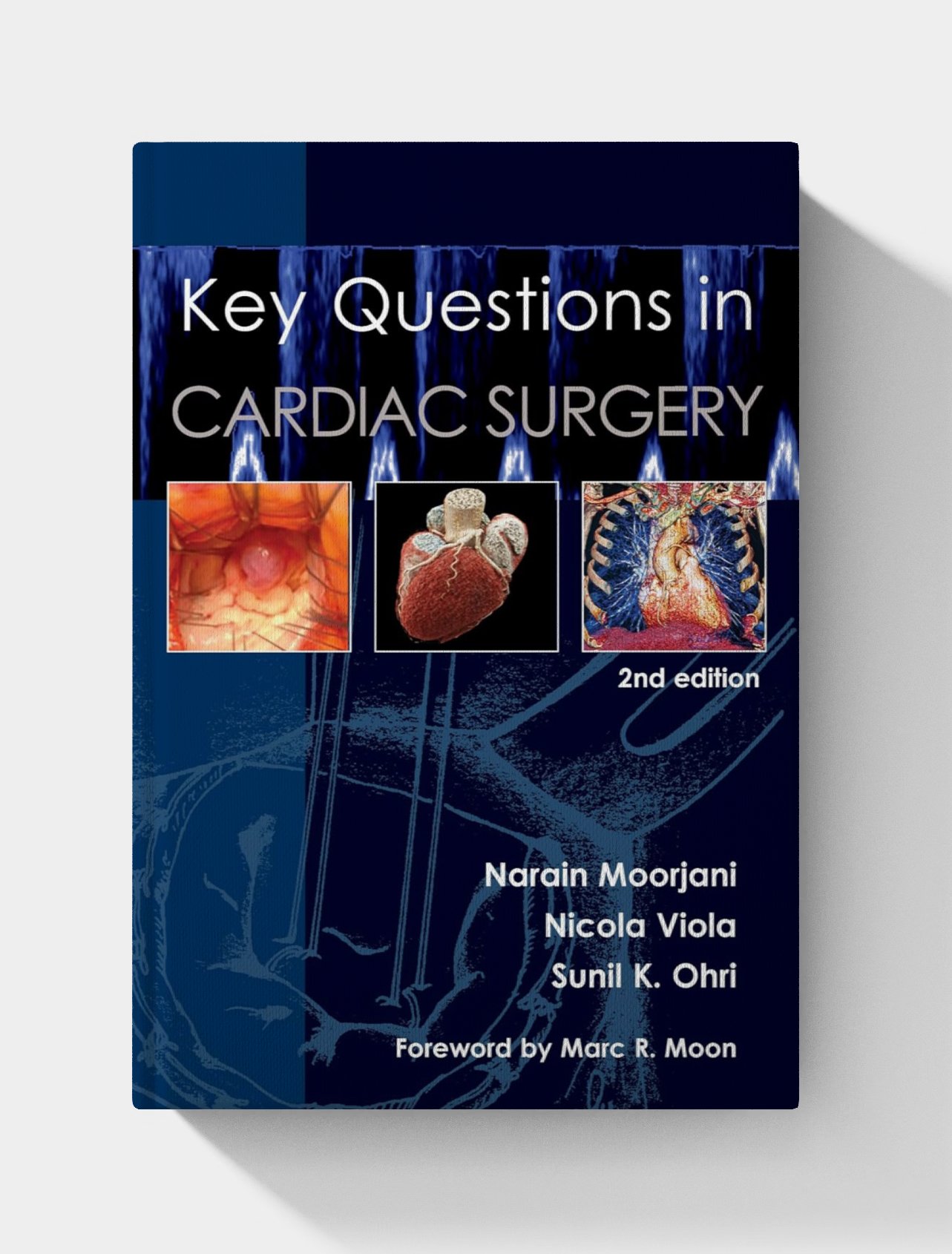 Key Questions in Cardiac Surgery (Key Questions, 4) 2nd Edition Key Questions in Cardiac Surgery (Key Questions, 4) 2nd Edition