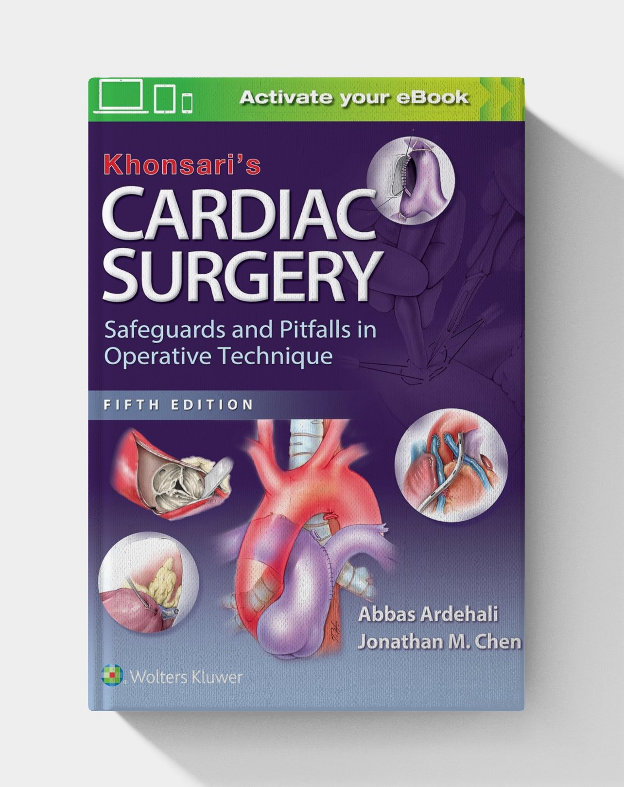 Khonsari's Cardiac Surgery: Safeguards and Pitfalls in Operative Technique (5th Edition) Khonsari's Cardiac Surgery: Safeguards and Pitfalls in Operative Technique (5th Edition)