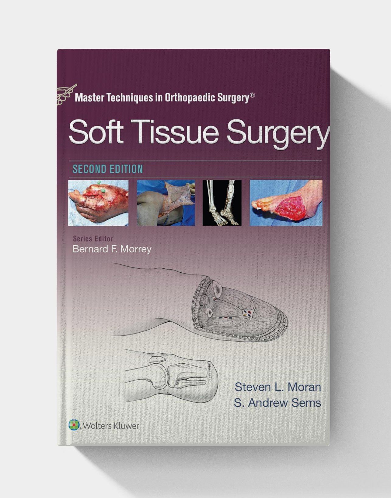 Master Techniques in Orthopaedic Surgery: Soft Tissue Surgery (2nd Edition) Master Techniques in Orthopaedic Surgery: Soft Tissue Surgery (2nd Edition)