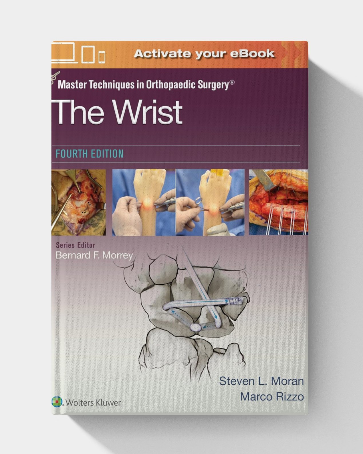 Master Techniques in Orthopaedic Surgery: The Wrist, 4th edition (PDF+ VIDEOS) Master Techniques in Orthopaedic Surgery: The Wrist, 4th edition (PDF+ VIDEOS)