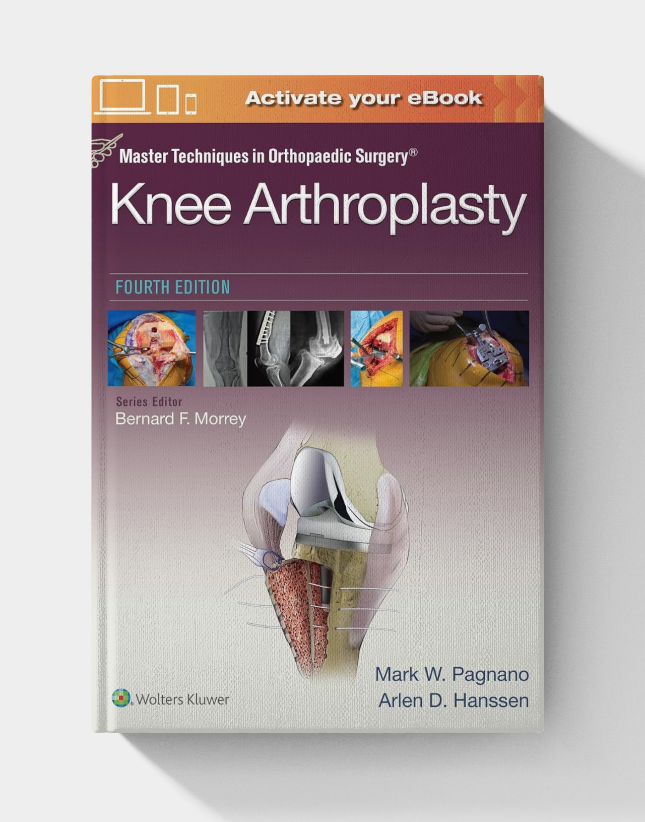 Master Techniques in Orthopedic Surgery: Knee Arthroplasty (4th Edition) Master Techniques in Orthopedic Surgery: Knee Arthroplasty (4th Edition)