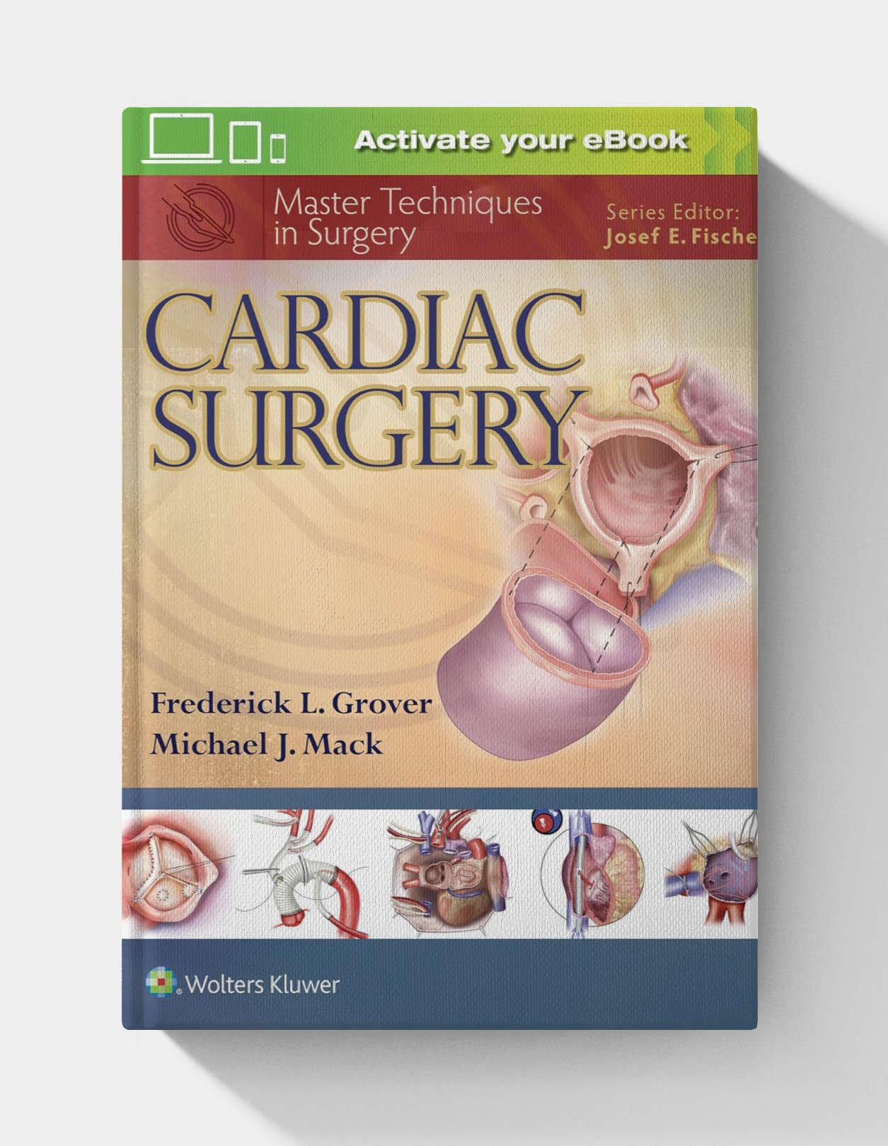 Master Techniques in Surgery: Cardiac Surgery Master Techniques in Surgery: Cardiac Surgery