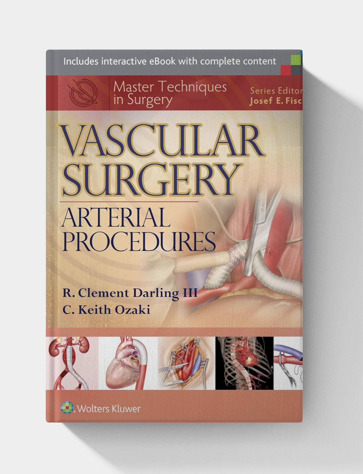 Master Techniques in Surgery: Vascular Surgery: Arterial Procedures (1st Edition) Master Techniques in Surgery: Vascular Surgery: Arterial Procedures (1st Edition)