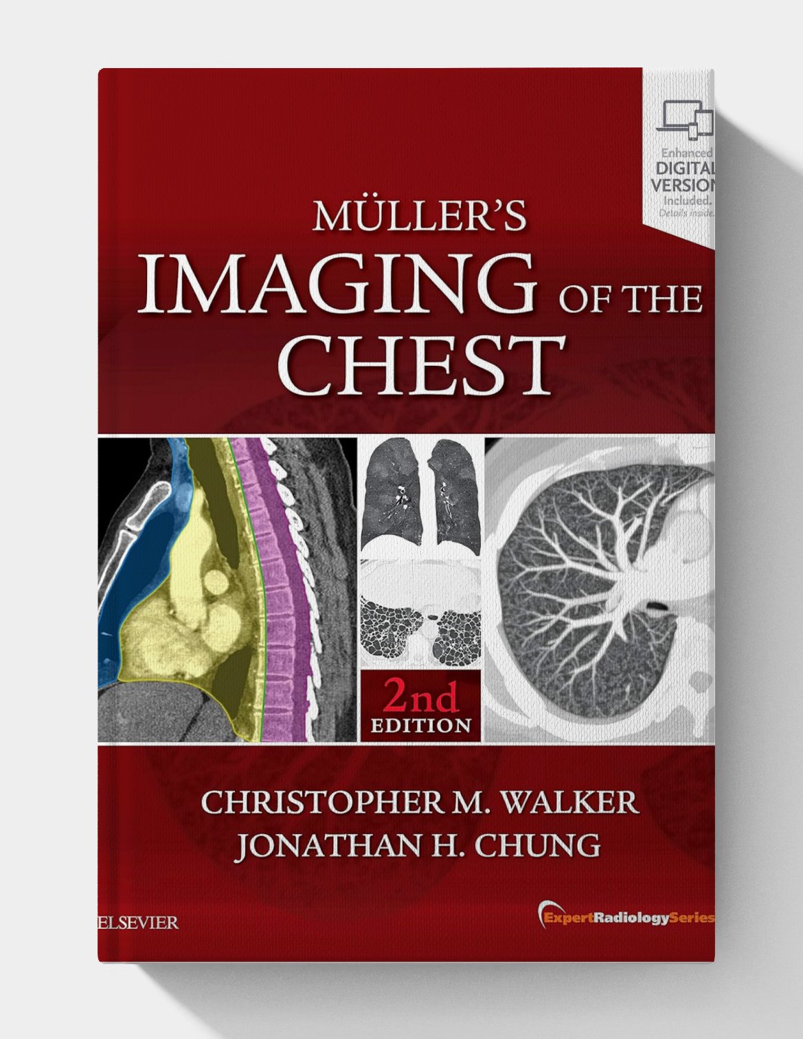 Muller's Imaging of the Chest: Expert Radiology Series (2nd Edition) Muller's Imaging of the Chest: Expert Radiology Series (2nd Edition)