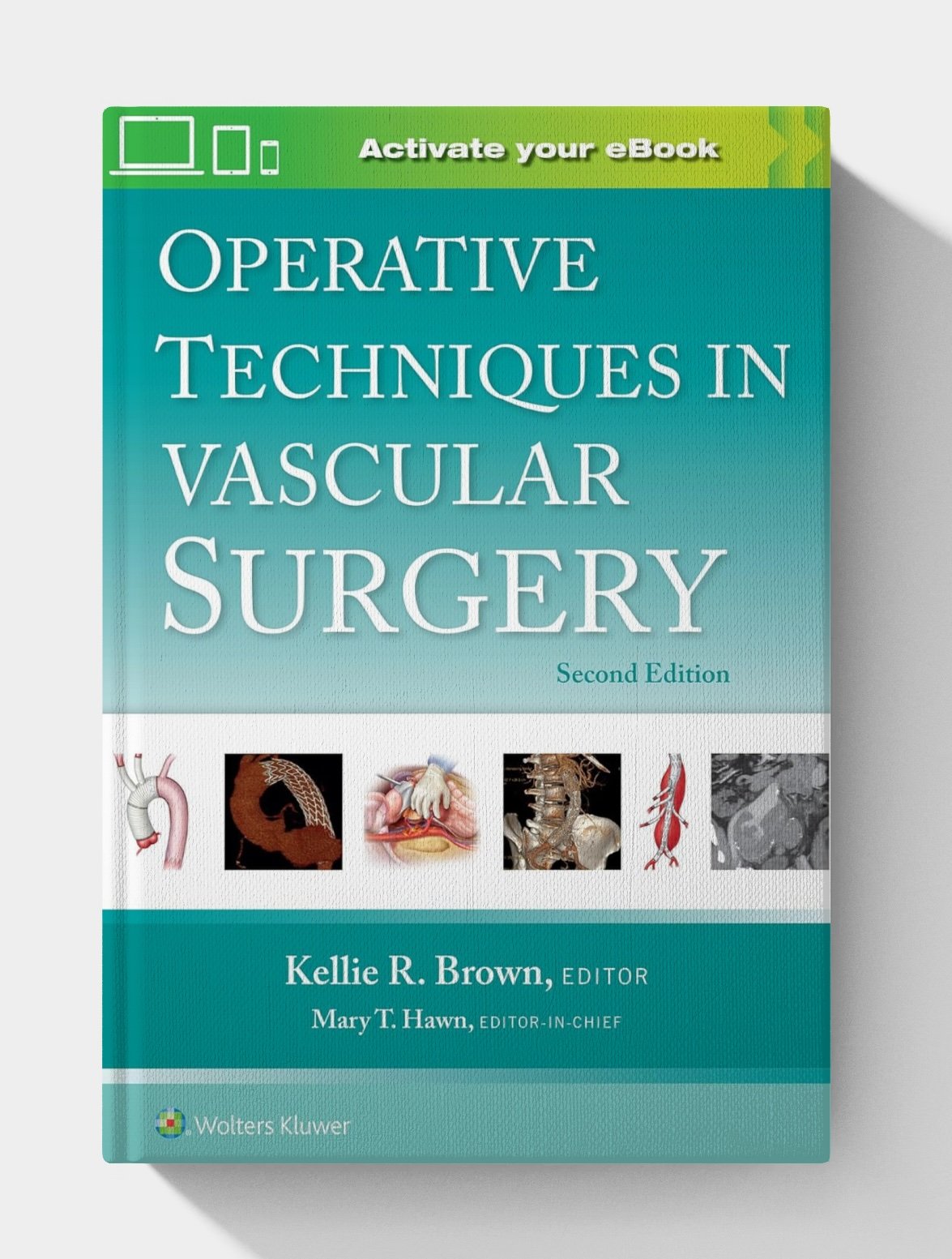 Operative Techniques in Vascular Surgery (2nd Edition) Operative Techniques in Vascular Surgery (2nd Edition)