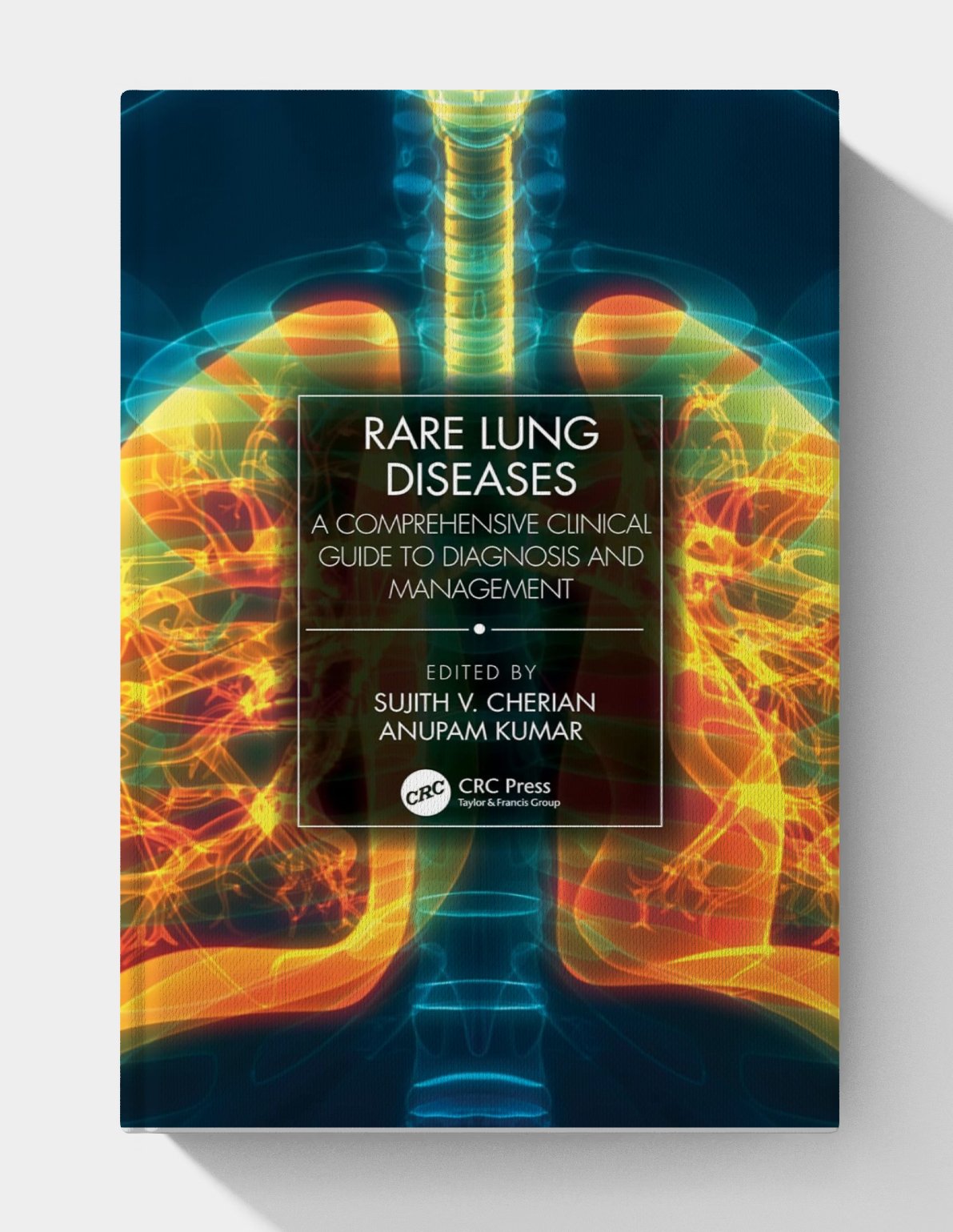 Rare Lung Diseases: A Comprehensive Clinical Guide to Diagnosis and Management (1st Edition) Rare Lung Diseases: A Comprehensive Clinical Guide to Diagnosis and Management (1st Edition)