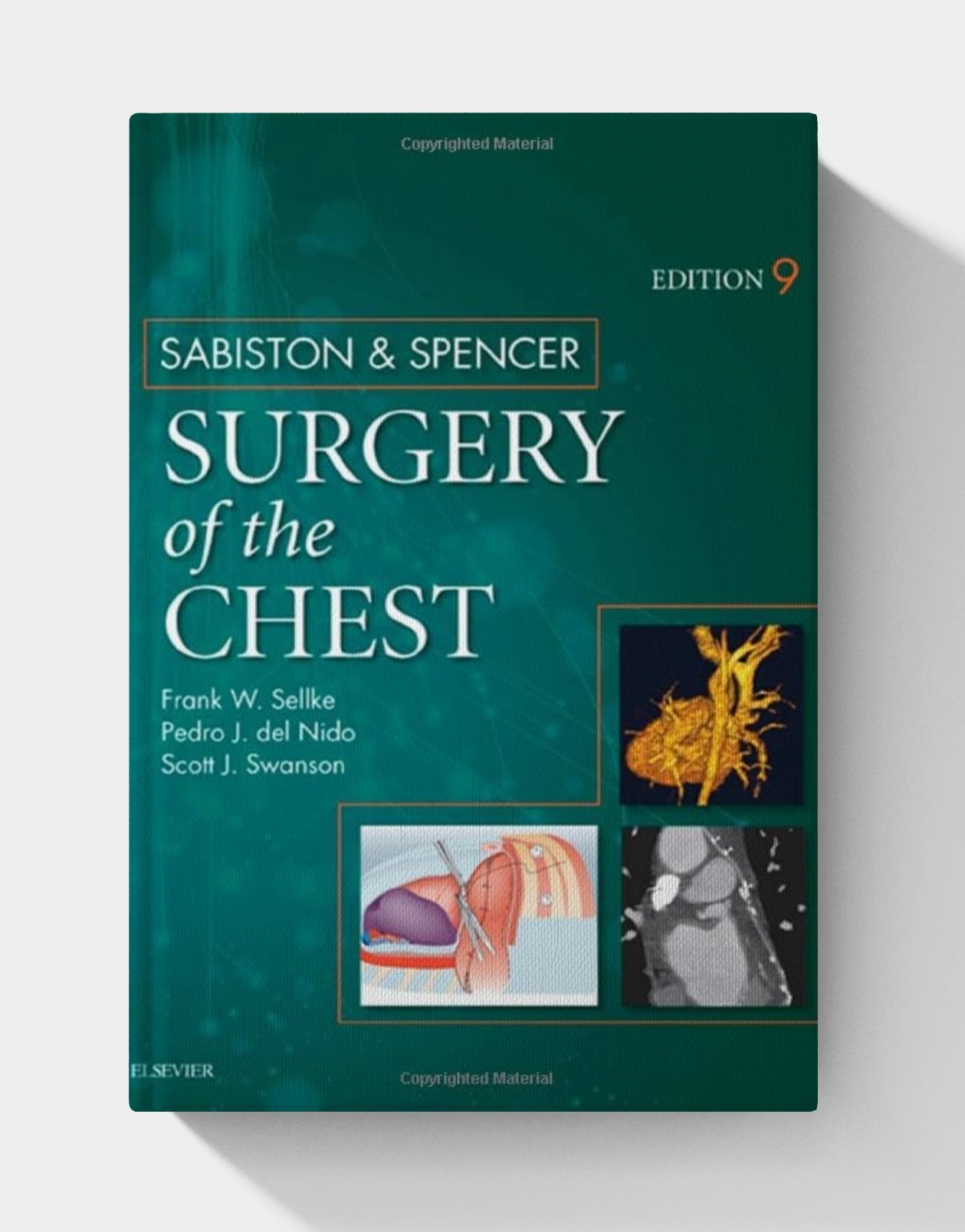Sabiston and Spencer Surgery of the Chest: 2-Volume Set (9th Edition) Sabiston and Spencer Surgery of the Chest: 2-Volume Set (9th Edition)