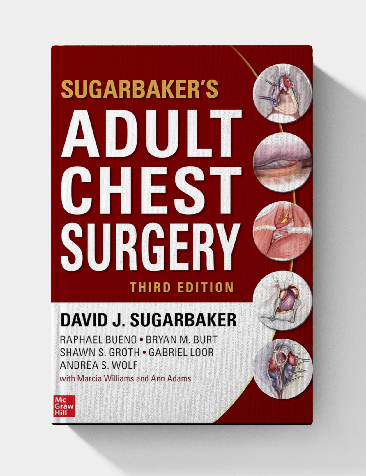 Sugarbaker's Adult Chest Surgery (3rd Edition) Sugarbaker's Adult Chest Surgery (3rd Edition)