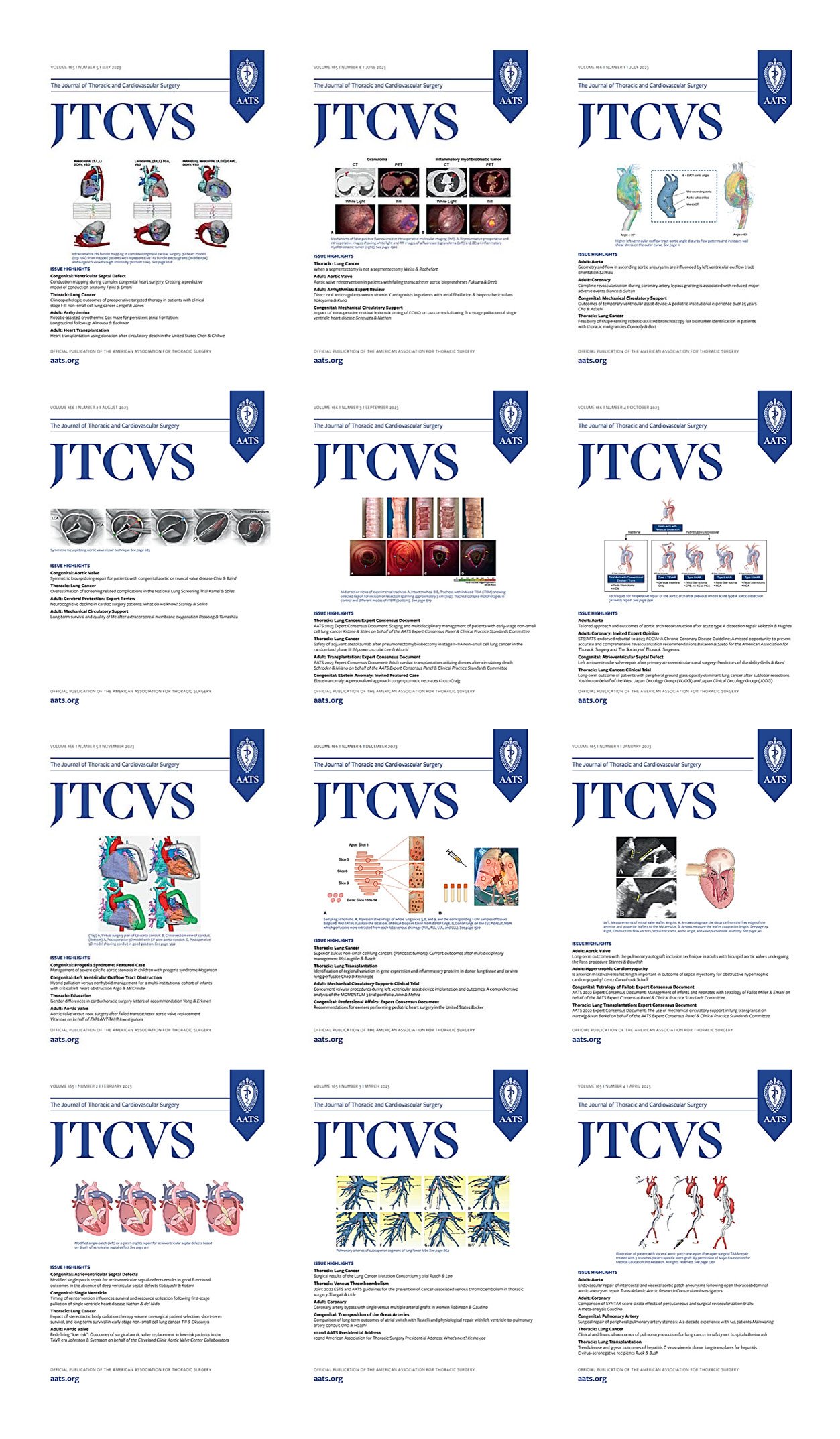 The Journal of Thoracic and Cardiovascular Surgery (2023) Full Archives The Journal of Thoracic and Cardiovascular Surgery (2023) Full Archives